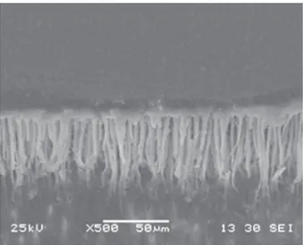 Figure 6- Photomicrograph of vestibular surface of Class  I cavity preparation restored with P90/ Silorane Adhesive  System