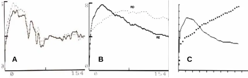 Figura  6.    Curvas    representativas  dos  três  grupos  de  acordo  com  a  excreção  do  DTPA:    (A)  ambas  as  unidades com excreção normal – grupo I; (B) uma unidade renal com padrão intermediário (linha pontilhada)  – grupo II; (C) uma unidade re