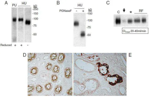 Fig. 5: Detecção de uromodulina no rim humano e na urina. (A) uromodulina purificada (PU, 0,5 mg) e de urina humana normal  (HU, 4 ml) foram submetidos a 7,5% de SDS-PAGE, transferidas para nitrocelulose e sondadas com anticorpos policlonais de  ovelha  co