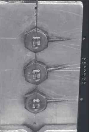 Figure 2- Middle bracket positioned with 10° of angulation