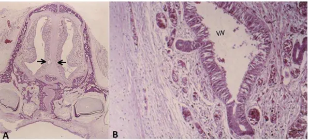 Figure 2-               !   columnar epithelial tissue. Presence of connective tissue and bone tissue in process of neoformation