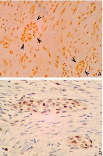 Table 1- Comparative analysis of data concerning the mean number of AgNOR per nucleus, area and proliferating cellular 