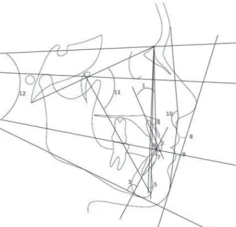 Figure 3- A) Manual tracing; B) Digitized lateral cephalograms; C) Lateral cephalograms from cone-beam computed  tomography (CBCT)