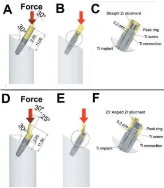 Figure 1-    (Zr) abutment showing the distances between the  abutment assembly and the potting surface and B) the     in C) where the component parts are described and  the circumferential 0.3 mm thicknesses of the zirconia  abutment at the connection is 