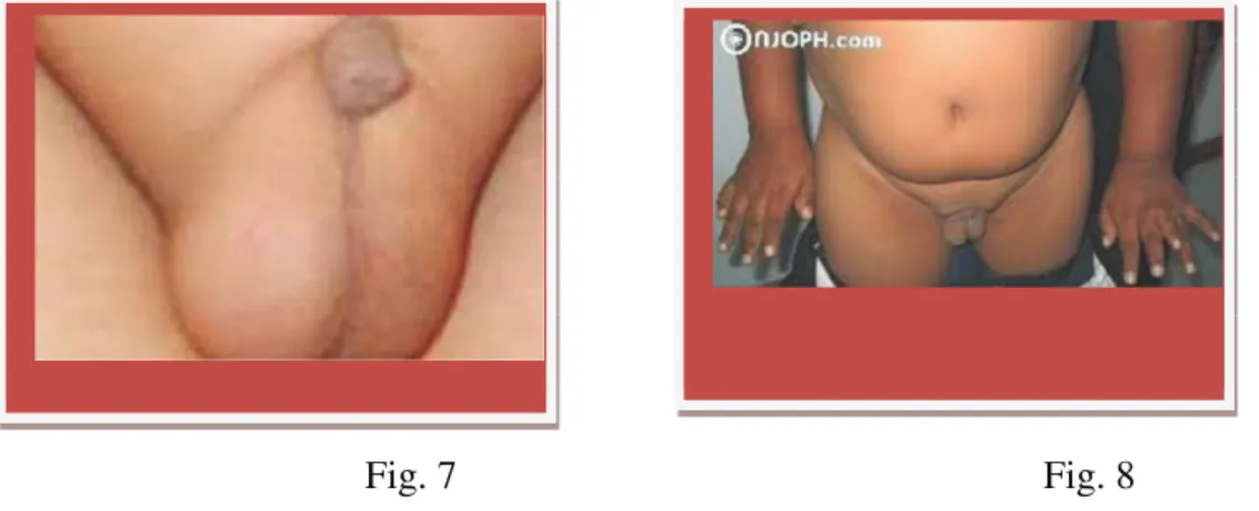 Fig. 7                                                           Fig. 8 