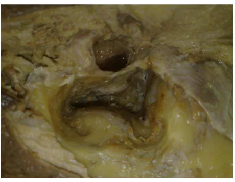 FIGURA 7 - Vista lateral de peça anatômica, lado esquerdo, que permite a  identificação após remoção de todos os canais semicirculares 
