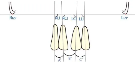 Figure 2-  Panoramic radiographic tracing showing the angles built by root long axes of the maxillary incisors and the  intermaxillary-zygomatic-processes (IZP) line, and the angles between adjacent incisors