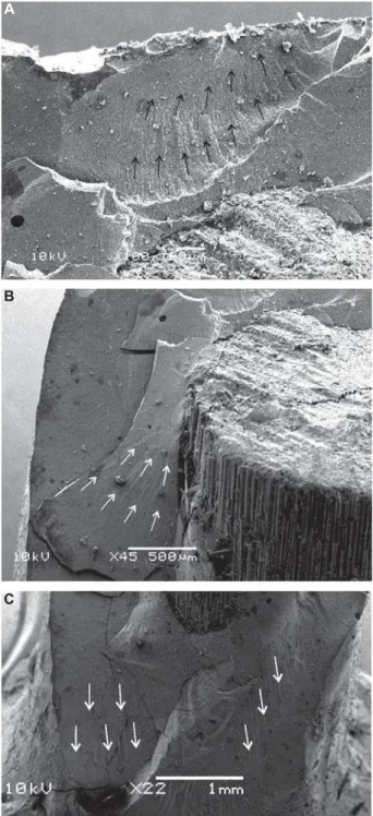 Figure 5- Scanning electron microscopy image of control  group. There is displacement of the buccal surface of the 