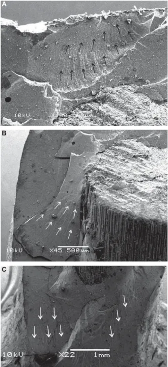 Figure 5- Scanning electron microscopy image of control  group. There is displacement of the buccal surface of the 