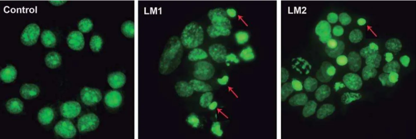 Figure 2- Morphological change of CAL 27 cells with apoptotic features. CAL-27 cells were treated with LM1 and LM2 for      !  apoptotic cells