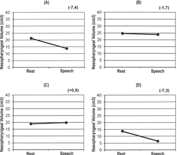 Figure 3-  Absolute nasopharyngeal volumes at VP rest and activity. (A) suggests good velopharyngeal structures movement  in an individual judged to have adequate velopharyngeal function