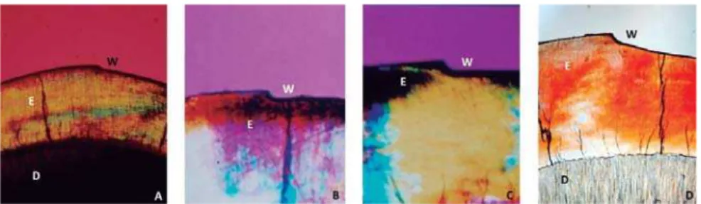 Figure 9- Ground section of an upper incisor tooth - Enamel/dentin interface. A: Incisal third analyzed by polarized light  microscope (25X); B