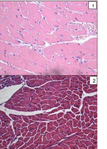 Figura  2-  Microfotografias  representativas  da  histologia  do  tecido  cardíaco  no  grupo  obeso  (painel  1)  e  no  grupo  controle  (painel  2)