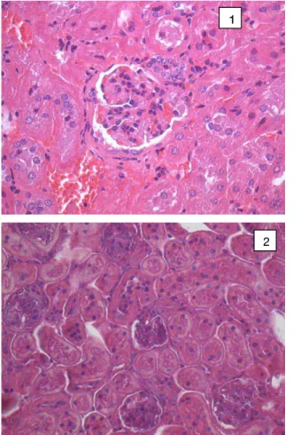 Figura  4-  Microfotografias  representativas  da  histologia  do  tecido  renal no grupo obeso (painel 1) e no grupo controle (painel 2)
