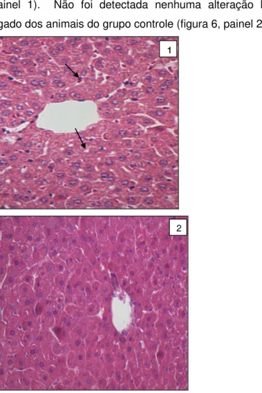 Figura  6  -  Microfotografias  representativas  da  histologia  do  tecido  hepático no grupo obeso (painel 1) e no grupo controle (painel 2)