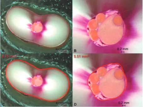 Figure 1- Coronal surfaces of the same slice after metallographic treatment. Total cross-sectional area (A) and canal  cross-sectional area (B)