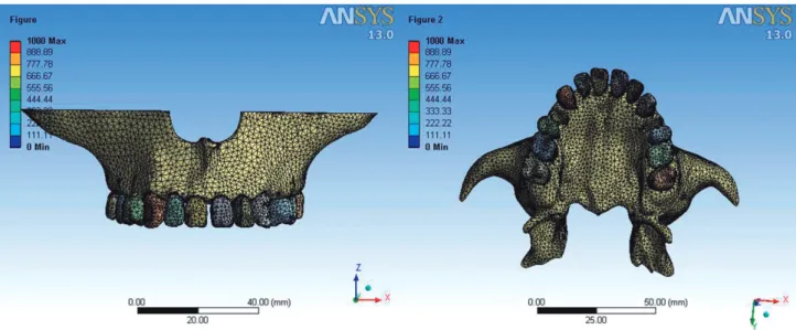 Figure 1- The initial 3D inite element model of the maxilla and the maxillary teeth