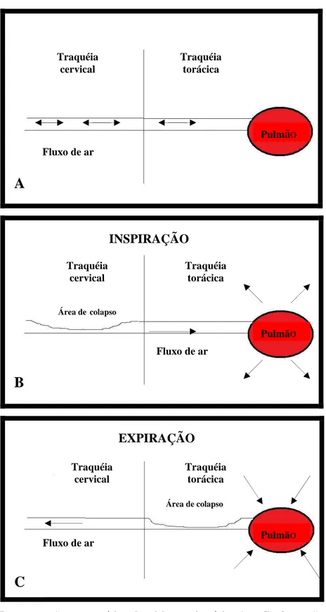 FIGURA  1  -  Representação  esquemática  do  ciclo  respiratório.  A  -  Conformação  normal  da  traquéia durante o ciclo respiratório