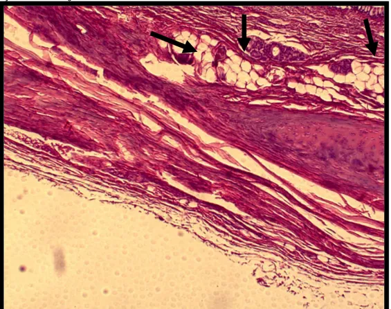 FIGURA  1.8  –  Anel  traqueal.  Área  de  substituição.  Observar  a  presença  de  células  adiposas  no  local de reparação por tecido conjuntivo fibroso (setas)