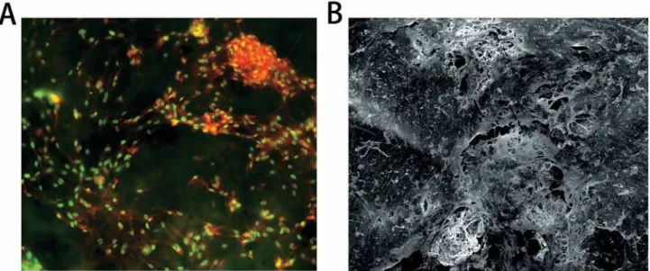 Figure 2- The microscopic observations of PDLtm. (A) Spindle PDLCs grew densely with nuclear in green-yellow and  cytoplasma in orange-red, 200×; (B) The PDLCs, secreted extracellular matrix (SEM) and PLGA scaffolds were integrated,  300×