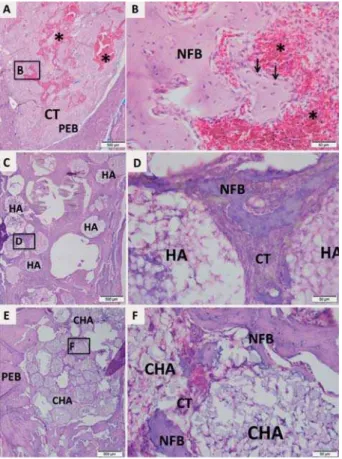 Figure 8- Representative photomicrographs of alveolar  socket after 42 days. A and B: Control group; C and D: HA  JURXS(DQG)&amp;+$JURXS7KHVPDOOVTXDUHVLGHQWL¿HG E\ % ' DQG ) DUH GLVSOD\HG DW IROG PDJQL¿FDWLRQ DGMDFHQWWRWKH¿JXUHVZLWKORZHUPDJQL¿FDWLRQ)LJXUHV