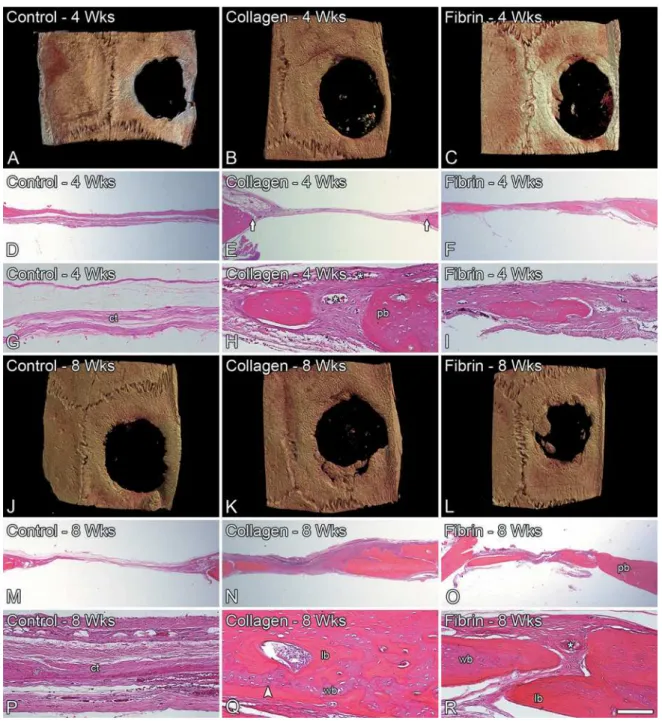 Figure 1- Three-dimensional reconstructed micro-CT images (A-C and J-L) and light microscopy (D-I and M-R) of untreated  rat calvarial bone defects (control) (A, D, G, J, M and P) and the ones treated with either collagen sponge (B, E, H, K, N and  4RU¿EUL