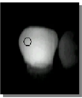 FIGURA 9  – Imagem digitalizada do sítio de calibração vestibular (dente 1), obtida  pelo método de fluorescência com laser de Argônio