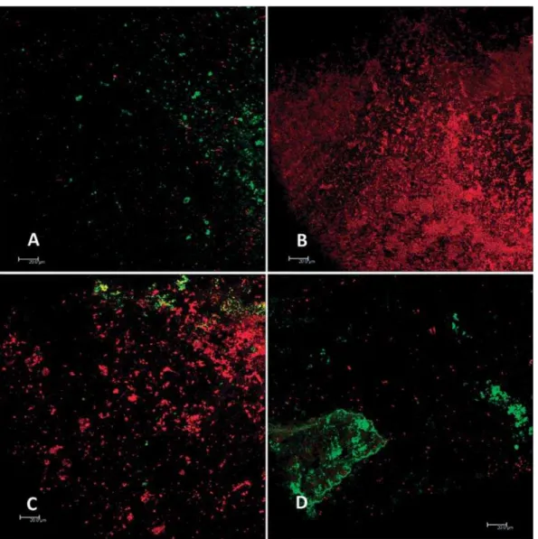 Figure 2- Representative confocal pictures after treatment with chlorhexidine 0.4%+calcium hydroxide (A); Casearia  sylvestris Sw+calcium hydroxide (B); Propylene glycol+calcium hydroxide (C); Positive control (D)