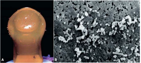 Figure 2- Brushtox ® &amp;RORQLHVELR¿OPVRIMutans streptococci after microbial culture (A) and scanning electron microscopy  micrograph (B)