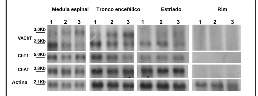 Figura 9: Análise dos níveis de RNA mensageiro dos animais VAChT mutantes: A) Membranas de PVDF contendo 5 a 10 microgramas de 