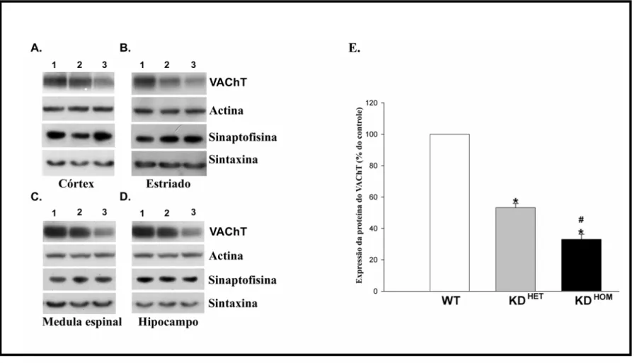 Figura 13: Análise da expressão protéica do VAChT e outras proteínas pré-sinápticas nos camundongos mutantes