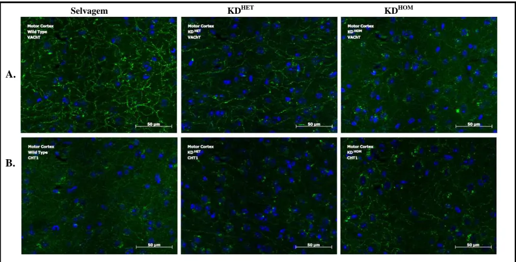 Figura 15: Imunofluorescência para o VAChT e CHT1 na região do córtex cerebral dos camundongos VAChT knockdown