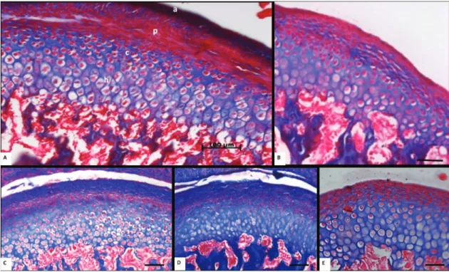 Figure 5- Light microscopy of the mandible condylar process cartilage (CP) of Wistar rats