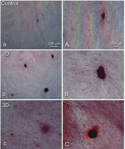 Figure 6- Alizarin red staining of mineralized nodule formation in hPDLF cultures. Control (a and A), 2D collagen (b and B),  and 3D collagen (c and C)