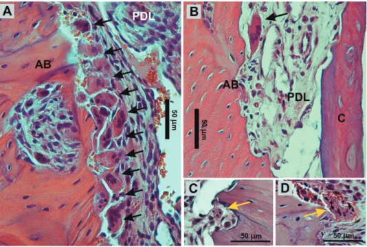 Figure 5- Micrograph of the compression side of a right irst molar from A: control and B: experimental group