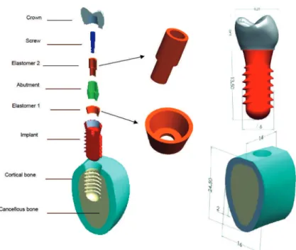 Figure 1- Components of an Osteoplant ®  implant model with two incorporated elastomeric stress absorbers with global  data form 2()( )( )aMPaF Nσ=S mm