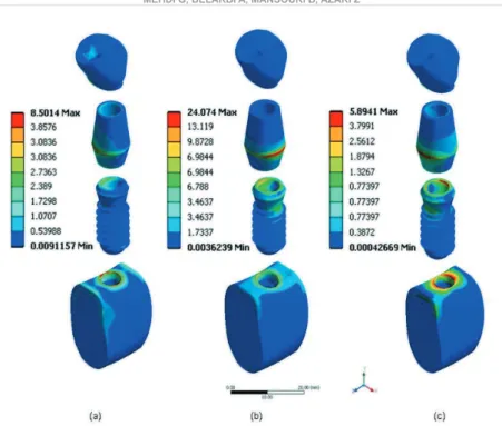 Figure 6- Von Mises stress levels in the elastomeric implant model components under different load cases