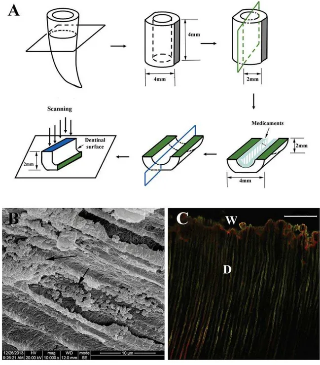 Figure 1- Schematic drawings of sample preparation and medication. (A) Bacterial colonization in dentinal tubules; (B)  Successful bacterial colonization in dentinal tubules was shown by scanning eletron microscopy observation (black arrow); 