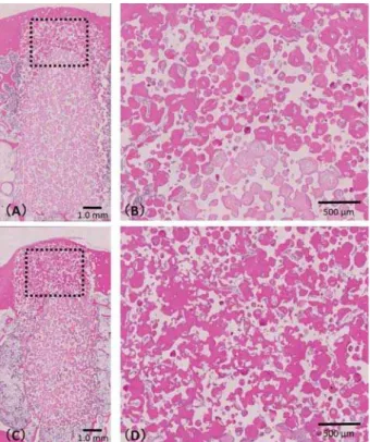 Figure 5 shows sample B with the right side  implant. New bone formation from preexisting  cortical bone was detected at the IP-CHA site and 