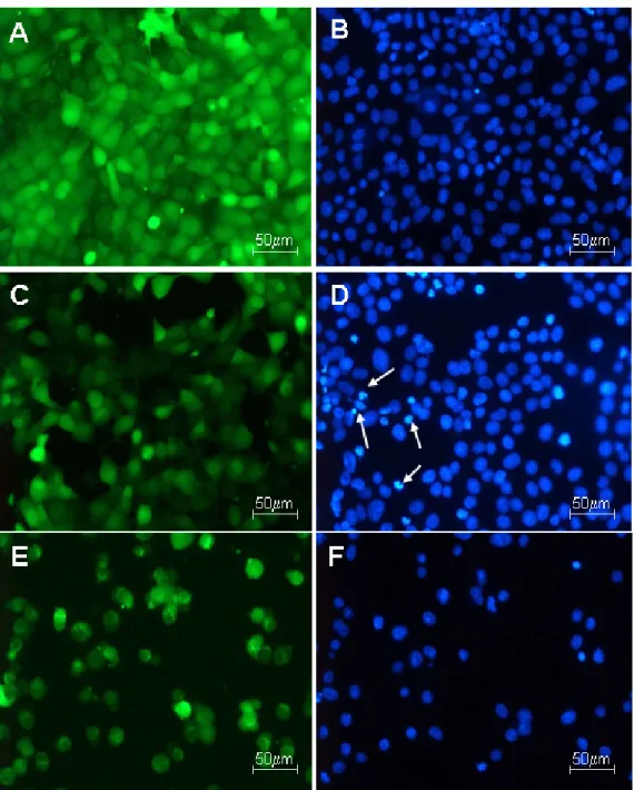 Fig. 1.  Fluorescence microscopy of HeLa cells (on the left, BCECF cytoplasmatic dye and on the right, Hoechst  33342 nuclear dye)