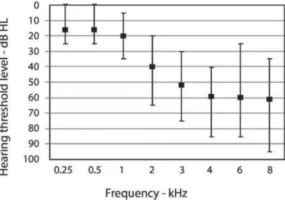 Figure 1- Averages, minimum and maximum audiometric thresholds