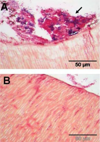 Figure 7- Transverse sections of human roots after 15 days  incubation in situ in subject 4