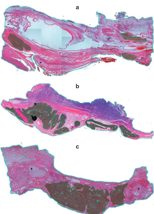 Figure 3- Histomorphometric analysis after reconstruction with autogenous bone graft, powdered synthetic hydroxyapatite  implant, andallogeneic cartilage graft, with or without exposure to buried magnetic ield, at 60 postoperative days (Blue  lines deine t