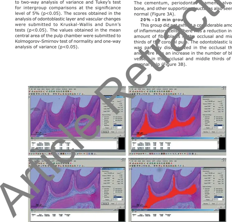 Figure 1- Central area measurement of the pulp chamber in the experimental groups using the Leica QWin V3 Image  Processing and Analysis Software (Leica Microsystems, Wetzlar, Hesse, Germany)
