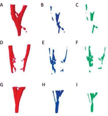 Figure 1- A, B and C represent specimens from the Conventional group; D, E and F from the PUI/NaOCl group; and 