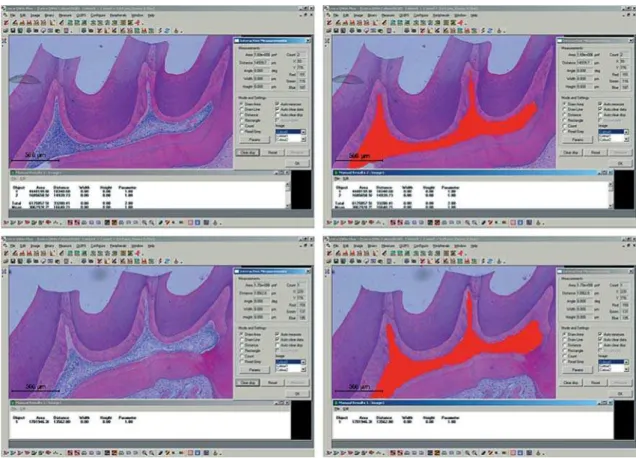 Figure 1- Measurement of the central area of the pulp chamber in the experimental groups using the Leica QWin V3 Image  Processing and Analysis Software