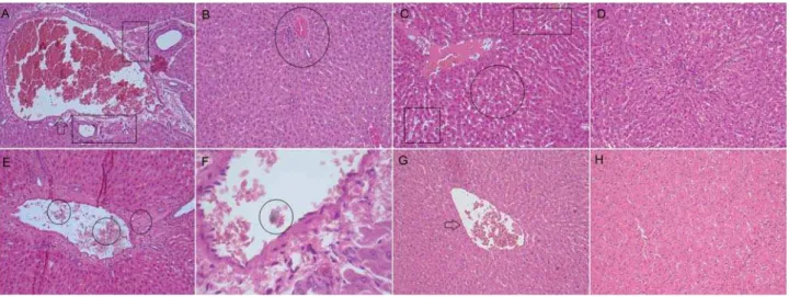 Figure 3- Photomicrographs of histological sections (5  μ m) of liver stained with hematoxylin and eosin