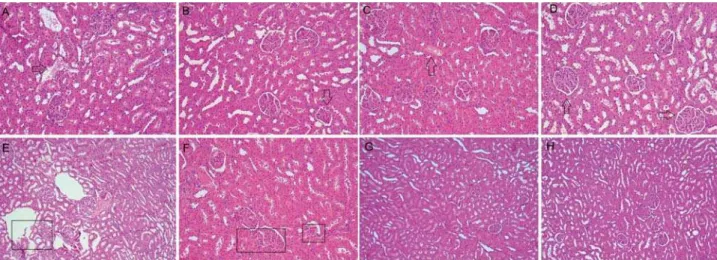 Figure 4- Photomicrographs of histological sections (5  μ m) of kidney stained with hematoxylin and eosin