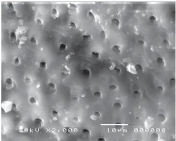 Figure 13- Electron-micrograph in control (CB) group subjected to  conventional high speed turbine bur before acid etching showing 