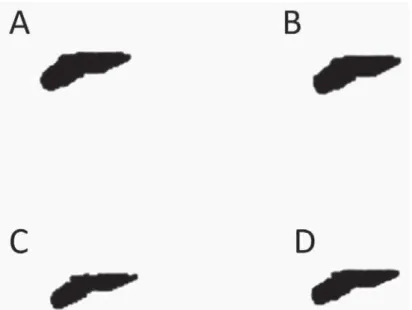 Table 1- Mean and standard deviation of canal volume and canal surface using different segmentation methodsFigure 